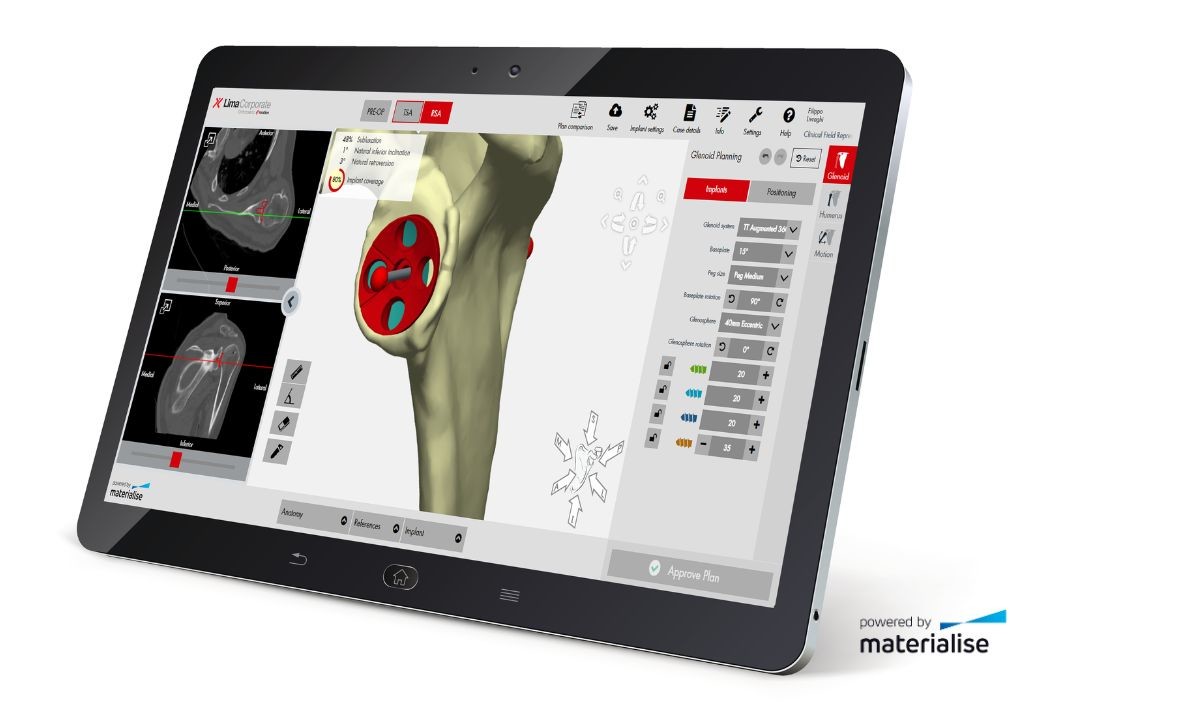 Shoulder Surgical Planner image